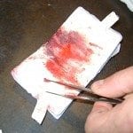 we took off his bandage and there was tissue and lots of blood