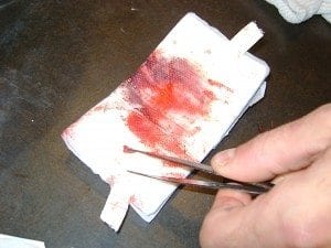 we took off his bandage and there was tissue and lots of blood