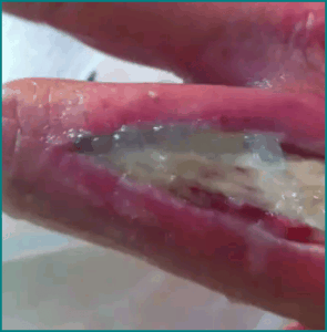 joesfinger1 joesfinger1