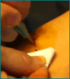 selfsurgery1 selfsurgery1