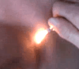 burningoffwart1 burningoffwart1