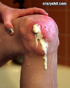 knee cheese anyone knee cheese anyone