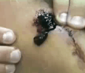 jellyknee1