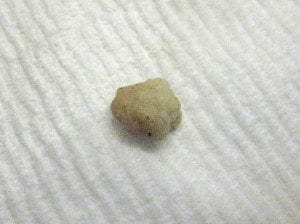 IMG_5604 IMG_5604
