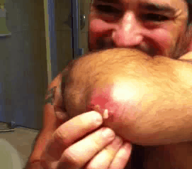 goutelbow1