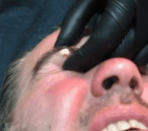kruseseye1 kruseseye1