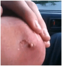 elbowooze1