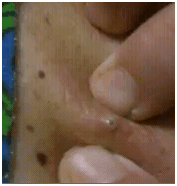 espinhagigante1