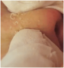 ooshlesnosesqueezins1