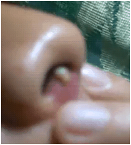pigsanose2 pigsanose2