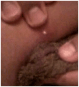poppingaboil2