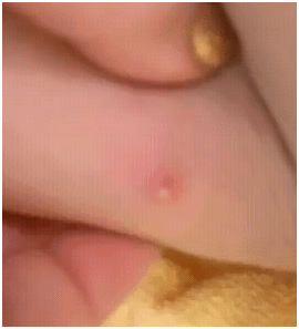 simplepopthigh1