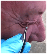 stoneagesurgery1 stoneagesurgery1