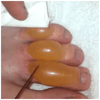 bubblytoes1 bubblytoes1