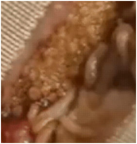 larvaetherapy1