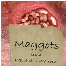woundmaggots1