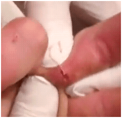 fingerzit1 fingerzit1