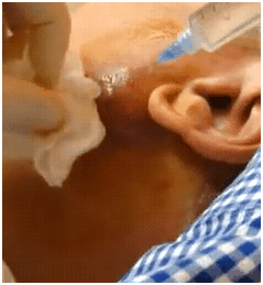 jawabscessexplodes1