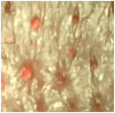 alienskin1 alienskin1