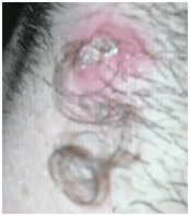 crazyingrownhairs1 crazyingrownhairs1