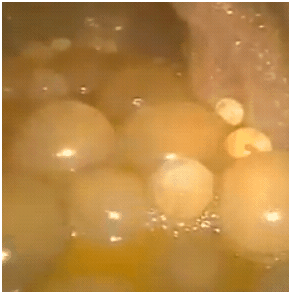 liverhydadtiddaughtercells1 liverhydadtiddaughtercells1