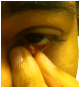 poppinganeyestye1 poppinganeyestye1