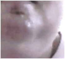 rosecoldsore2