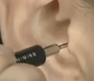 scratchasianeartool1 scratchasianeartool1