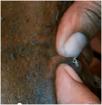 BigOldPIMPLE01102012B BigOldPIMPLE01102012B