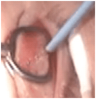 asoprschalazion01282012B asoprschalazion01282012B