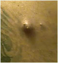 jOHNNYPimples01182012C jOHNNYPimples01182012C