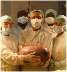 ovariancystdarfur01162012A