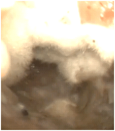 earfungus02042012A earfungus02042012A