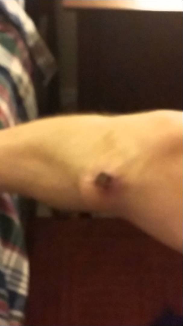 Ooze coming out of Bob’s leg!